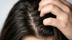 Fettige Haare loswerden: Hausmittel und Tipps für zu Hause